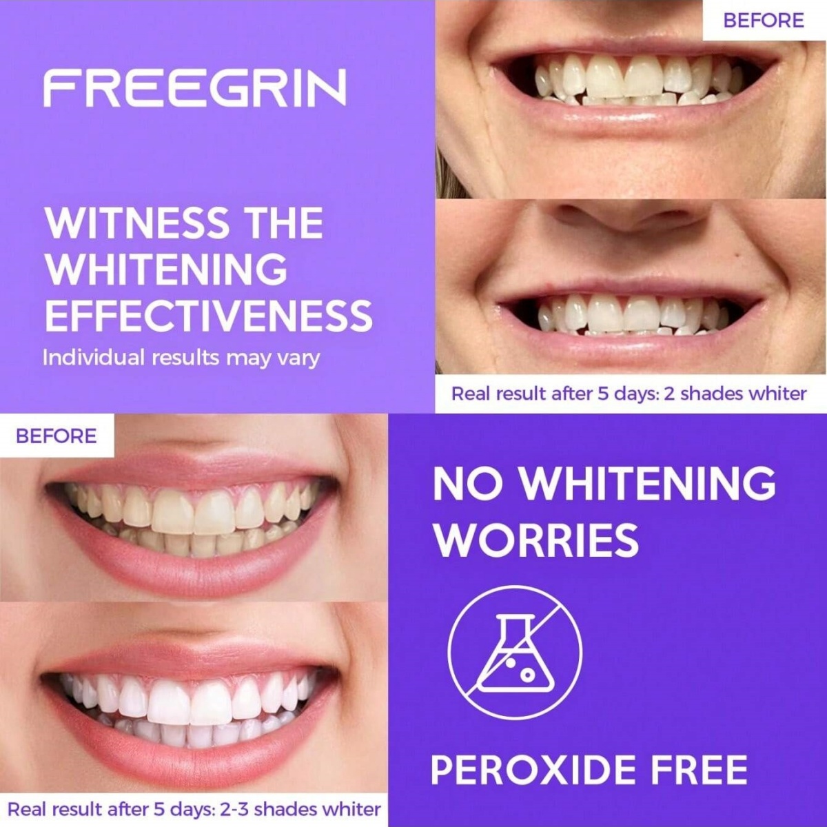 Deluxe Whitening Teeth Sticker - Home Fragrance Gel review and price